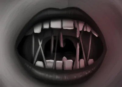 Illustration trap - Image 1