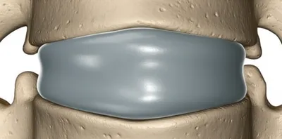 Illustration discs - Image 1