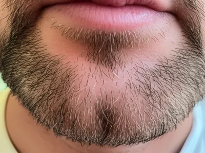 Hình ảnh minh họa beards - Ảnh 1