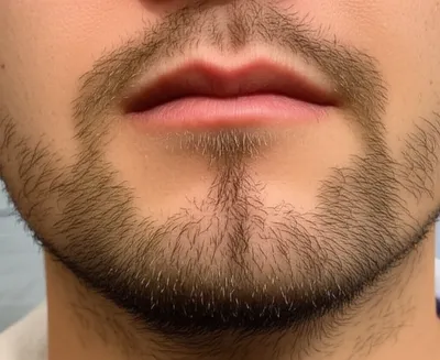 Illustration goatee - Image 1