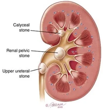 Illustration calculus - Image 2