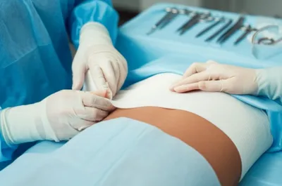 Illustration roller - Image 1