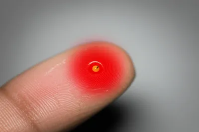 Illustration festers - Image 1