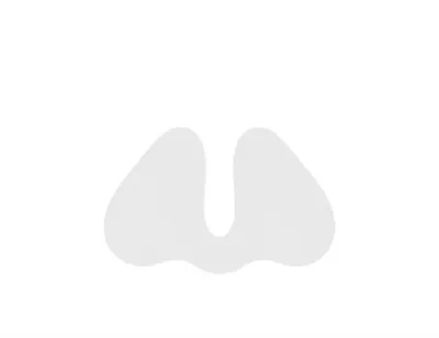 Illustration sinuses - Image 1