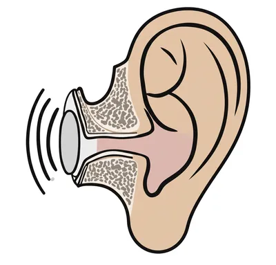 Illustration tympans - Image 1