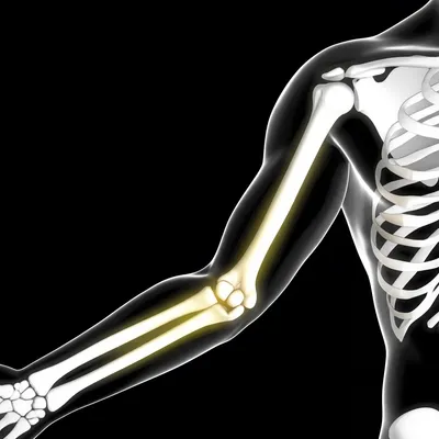 Illustration elbow - Image 1