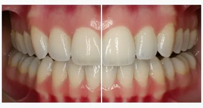 Illustration orthodontics