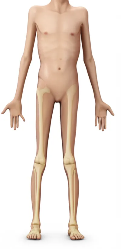 Illustration rickety - Image 1