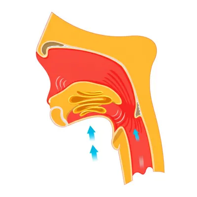 Illustration phonation