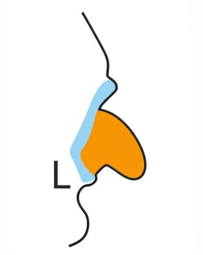 Illustration velarized - Image 1