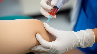 Illustration aspirate - Image 1