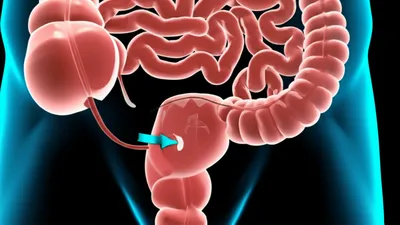 Illustration rectal - Image 1