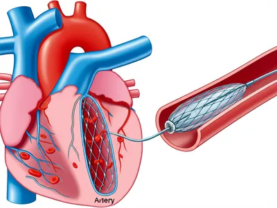 Illustration balloons - Image 1