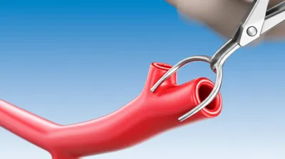 Illustration clamps - Image 1