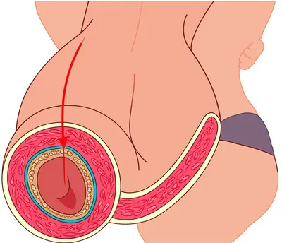 Illustration sodded - Image 1