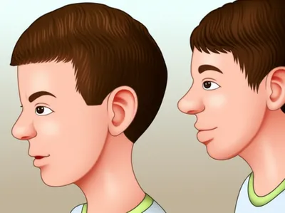 Illustration brake - Image 1