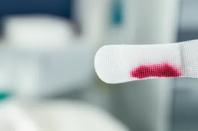 Illustration bleeds - Image 1