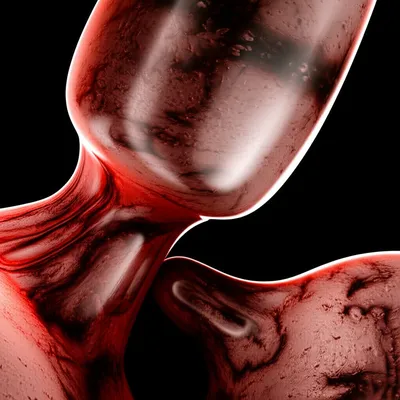 Illustration plugging - Image 1