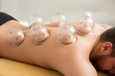 Illustration ventouses - Image 1