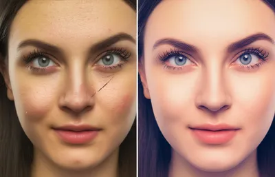 Illustration retouches - Image 1