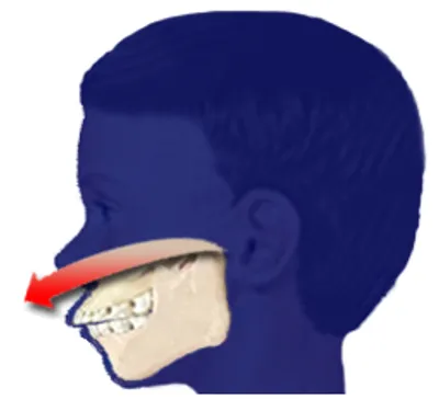 Illustration overshot - Image 4