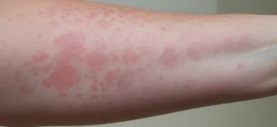 Illustration blotched - Image 1