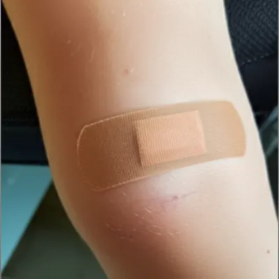 Illustration scars - Image 1