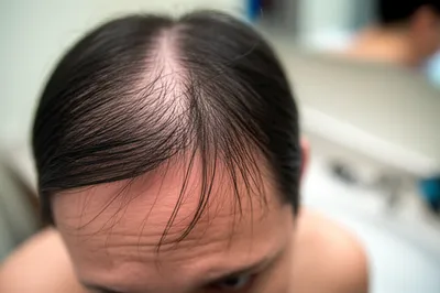 Illustration effluvia - Image 1