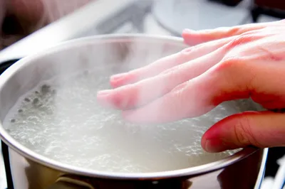 Illustration scalding - Image 1