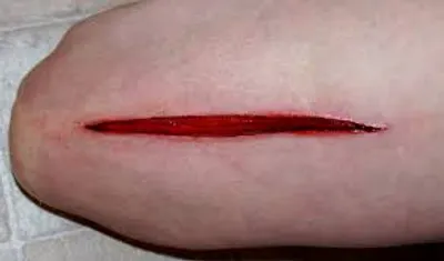 Illustration gaping - Image 2