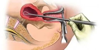 Illustration scrape - Image 2