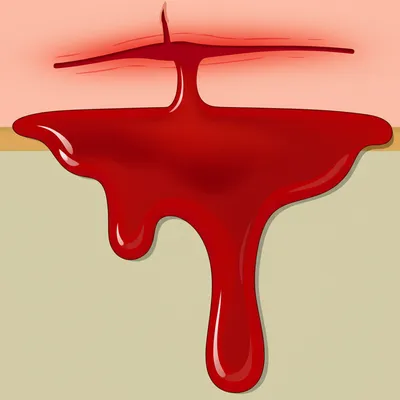 Illustration stanch - Image 1