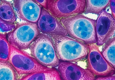 Illustration stains - Image 1