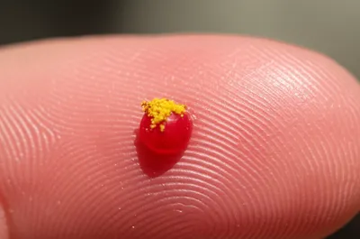 Illustration hypersensitive