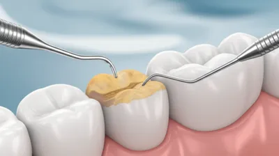 Illustration scaling - Image 1