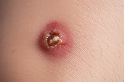 Illustration rankled - Image 1