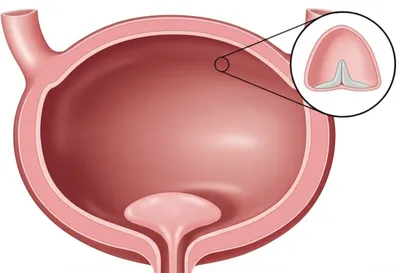 Illustration trigones - Image 1