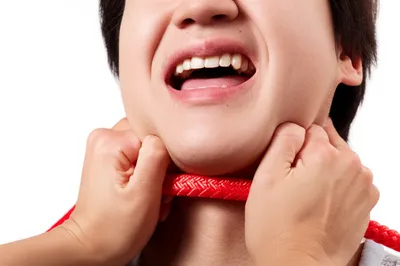 Illustration strangulate - Image 1