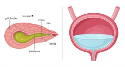 Illustration cystic - Image 1