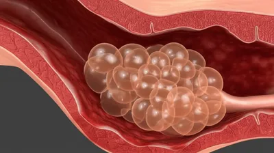 Illustration mole - Image 1