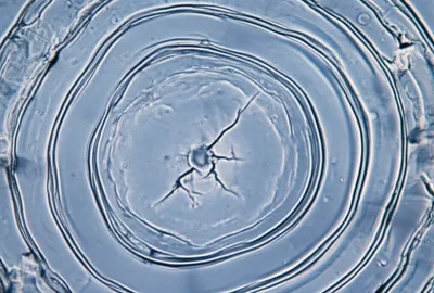 Illustration hilum - Image 1