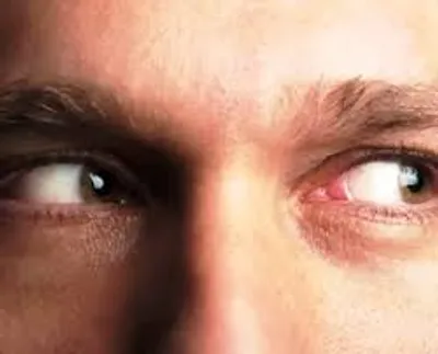 Illustration glance - Image 2