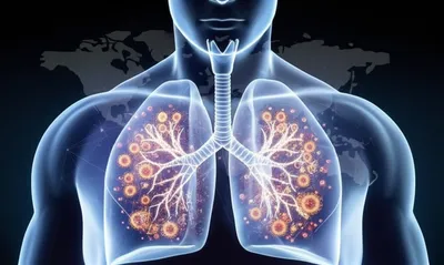 Illustration covid - Image 1