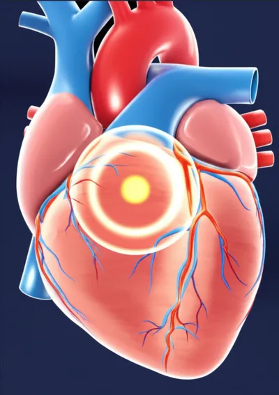 Illustration reentry - Image 1