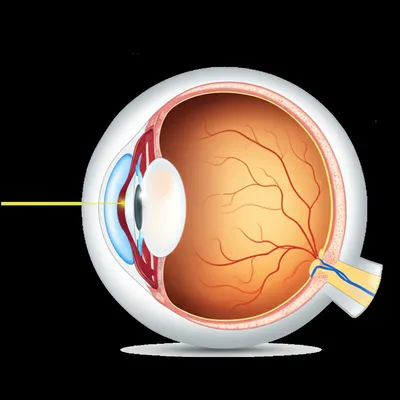 Illustration ophthalmology