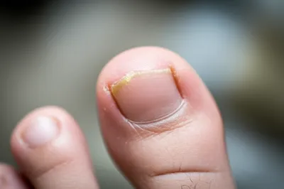 Illustration corns - Image 1