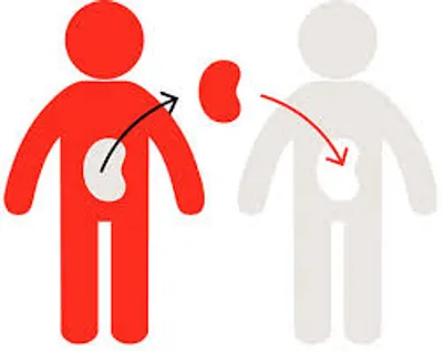 Illustration transplant - Image 3