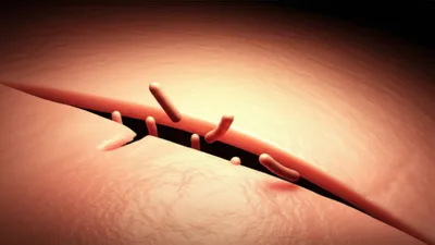 Illustration invasions - Image 1