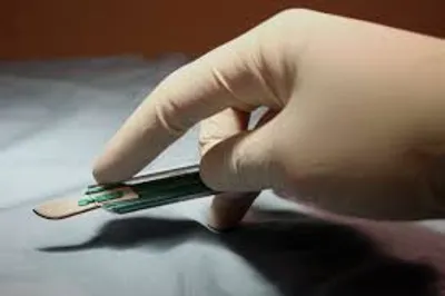 Illustration scalpel - Image 2