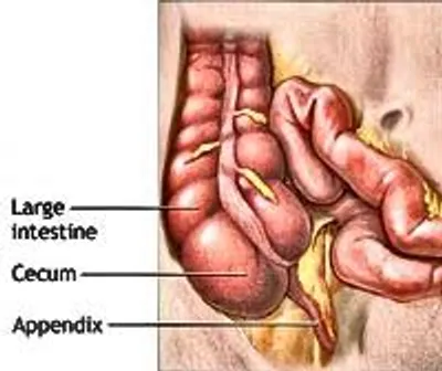 Illustration appendix - Image 2